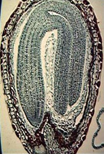 Section through a Capsella seed