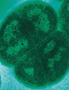 Deinococcus radiodurans