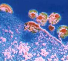 The deadly AIDS virus