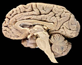 Our brain